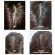 Dr.FORHAIR Folligen Tonic – стимулюючий тонік для росту волосся 4 з 4