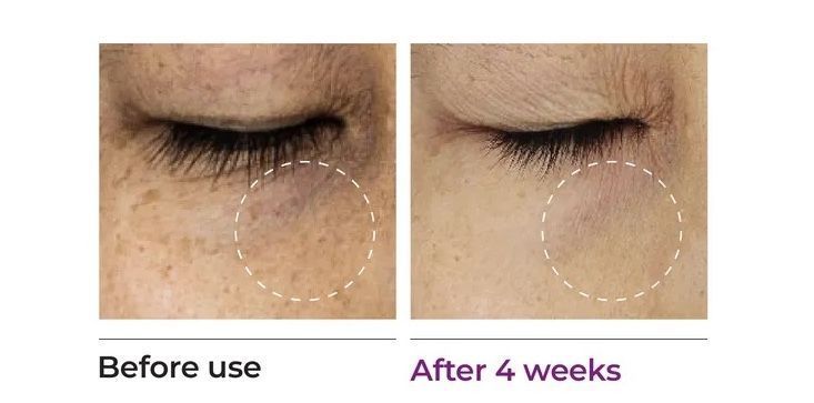 JUMISO Niacinamide 5+ Dark Circle Correcting Eye Cream &ndash; крем під очі проти темних кіл з кофеїном і ніацинамідом