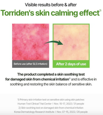 Torriden Balanceful Cica Cream – балансуючий гель-крем для чутливої і комбінованої шкіри