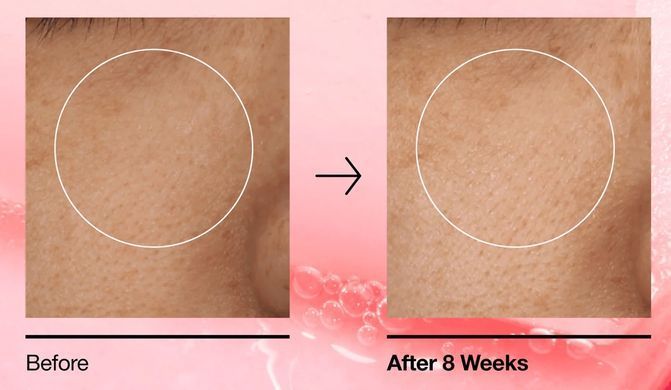 ANUA Niacinamide 5 TXA Brightening Pad &ndash; освітлювальні тонер-пади з ніацинамідом і транексамовою кислотою
