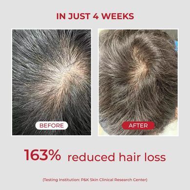 MOEV Annurcatin Shampoo &ndash; шампунь для зміцнення та обʼєму тонкого волосся