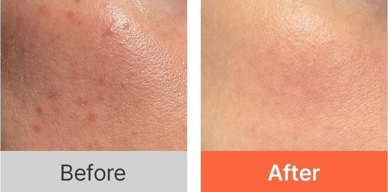 Hanskin Vitamin C Glow Serum &ndash; сироватка для сяйва з вітаміном С