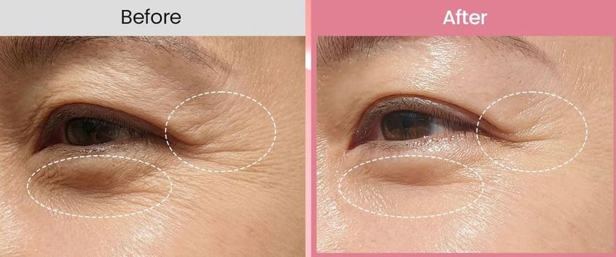 Biodance Collagen Peptide Eye Patches &ndash; патчі під очі з колагеном і пептидами