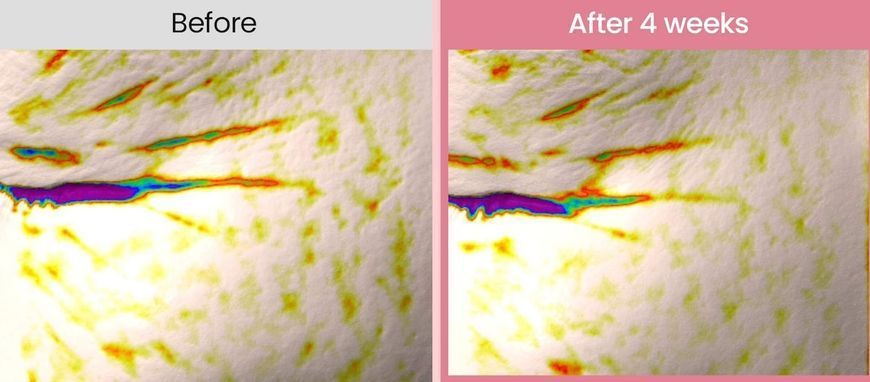 Biodance Collagen Peptide Eye Patches &ndash; патчі під очі з колагеном і пептидами