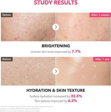 April Skin TXA Niacinamide 99 Milky Toner &ndash; освітлювальний тонер з ніацинамідом 5% і транексамовою кислотою
