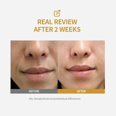 Sungboon Editor Silk Peptide Intensive Lifting Ampoule &ndash; інтенсивна ампульна сироватка з шовком і пептидами