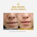 Sungboon Editor Silk Peptide Intensive Lifting Ampoule &ndash; інтенсивна ампульна сироватка з шовком і пептидами 4 з 4