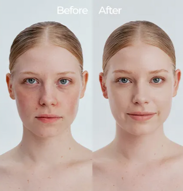 Cell Fusion C Skin Blemish Balm Intensive &ndash; BB крем для маскування почервонінь і висипань