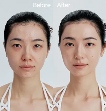 Cell Fusion C Skin Blemish Balm Intensive &ndash; BB крем для маскування почервонінь і висипань