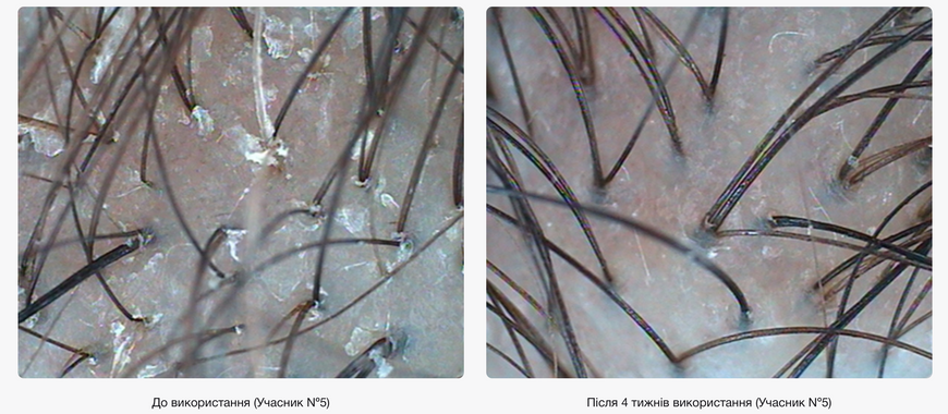 WhoCares Shampoo №1 Fundamental Repair &ndash; очищуючий шампунь
