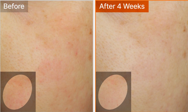 Tage Ferulic Triple Toning Vita Serum &ndash; освітлювальна сироватка з вітаміном С і феруловою кислотою