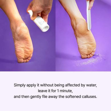 Baren Foot Spray Sofrener &ndash; спрей для видалення мозолів
