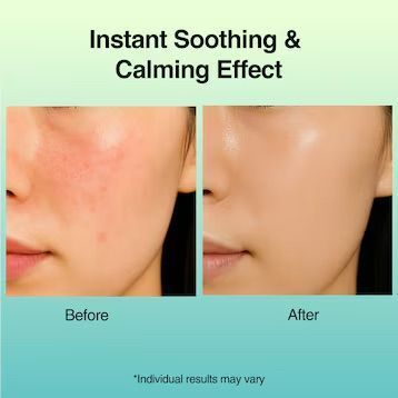 HIDEHERE Cica Care Toner Emulsion &ndash; тонер-емульсія з центелою