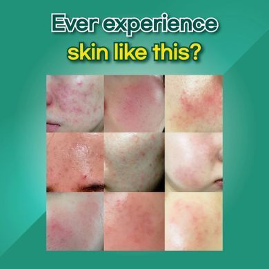 HYAAH Allinone Ectoin Lotion &ndash; зволожуючий лосьйон з ектоїном