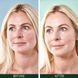 Sorted Skin 5 in 1 Anti-Redness Day Cream &ndash; денний крем проти почервонінь 5 в 1 3 з 3