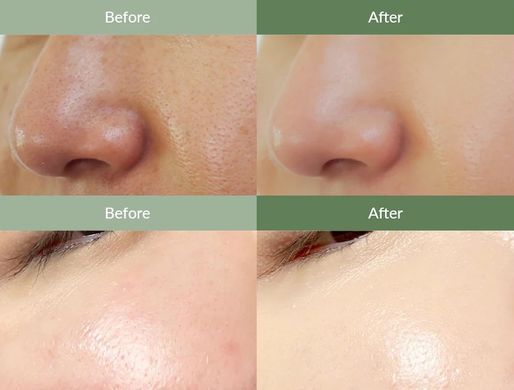 Dr.Althea Premium Quick Step Sebum Cleanser &ndash; засіб для очищення чорних цяток