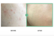 Celimax Heartleaf BHA Peeling Pad &ndash; тонер-пади з саліциловою кислотою та хауттюйнією серцевидною 5 з 5