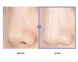 Celimax Heartleaf BHA Peeling Pad &ndash; тонер-пади з саліциловою кислотою та хауттюйнією серцевидною 4 з 5