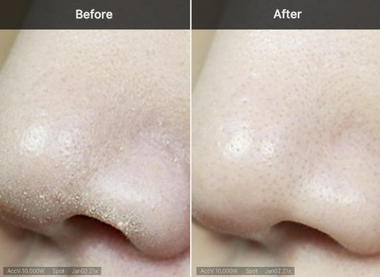 Medicube Zero Foam Cleanser &ndash; пінка с екстрактом мелісси для глибокого очищення пор