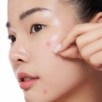 By Wishtrend Mandelic Acid Spot Clearing Patch &ndash; патчі з мигдальною кислотою від висипань та постакне