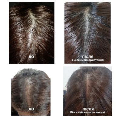 Dr.FORHAIR Folligen Tonic – стимулюючий тонік для росту волосся