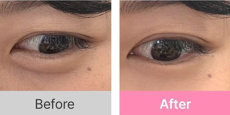 Hanskin Real Complexion Hyaluron Eye Serum &ndash; зволожуюча сироватка під очі з масажером-аплікатором