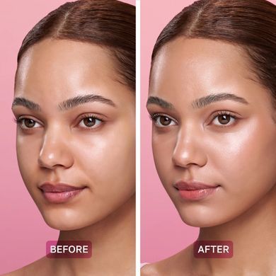 By Juccy Gooseberry Dark Spot Brightening Serum &ndash; освітлювальна вітамінна сироватка для обличчя