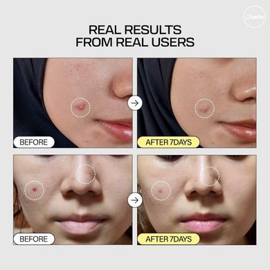 Jumiso Snail Mucin 95 + Peptide Facial Essence &ndash; есенція з муцином равлика 95% + пептиди