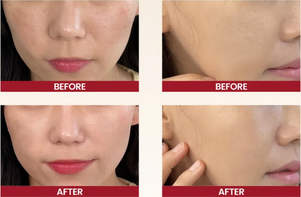 KSECRET SEOUL 1988 Cream : Snail Mucin 93% + Rice &ndash; крем з муцином равлика і рисом