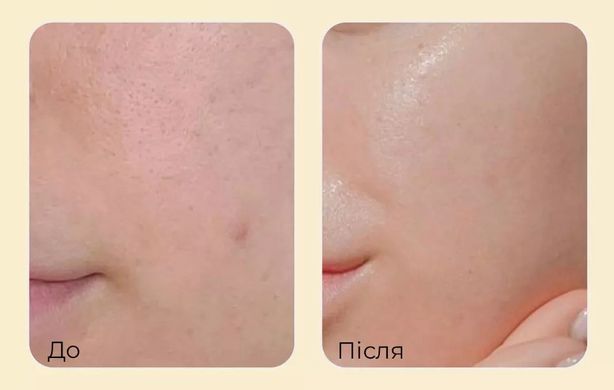 Medi-Peel Cell Tox Dermajours Toner &ndash; тонер омолоджувальний зі стовбуровими клітинами