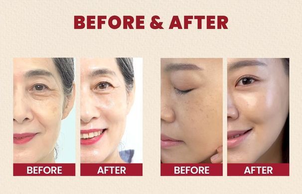 KSECRET SEOUL 1988 Serum : Retinal Liposome 2% + Black Ginseng &ndash; сироватка з ліпосомальним ретиналем 2% і чорним женьшенем