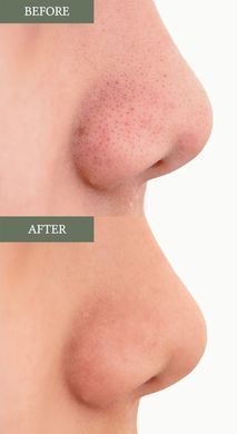 Dr.Althea Anastatica Skin Conditioning Pad &ndash; зволожуючі тонер-пади з ієрихонською трояндою