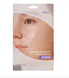 Isntree Onion Newpair Spot Patch Skin Fit &ndash; тонкі патчі проти прищів 1 з 3