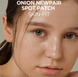 Isntree Onion Newpair Spot Patch Skin Fit &ndash; тонкі патчі проти прищів 2 з 3