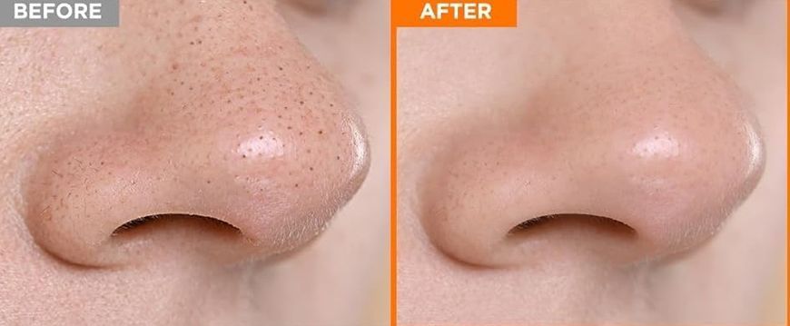 Hanskin Pore Cleansing Balm AHA &ndash; гідрофільний бальзам для очищення макіяжу з AHA кислотами