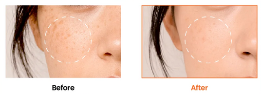 Купити KSECRET SEOUL 1988 Glow Serum : Niacinamide 15% + Yuja
