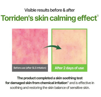 Torriden Balanceful Cica Serum – балансуюча сироватка для чутливої та комбінованої шкіри